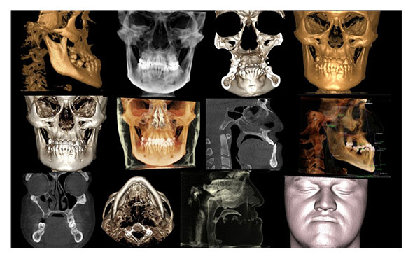 Paquetes de Ortodoncia