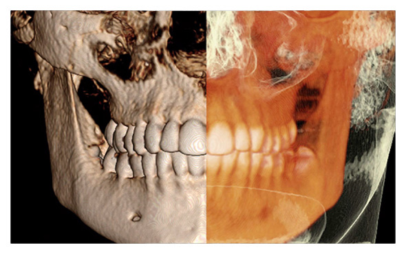 Tomografa 3D - Cone Beam